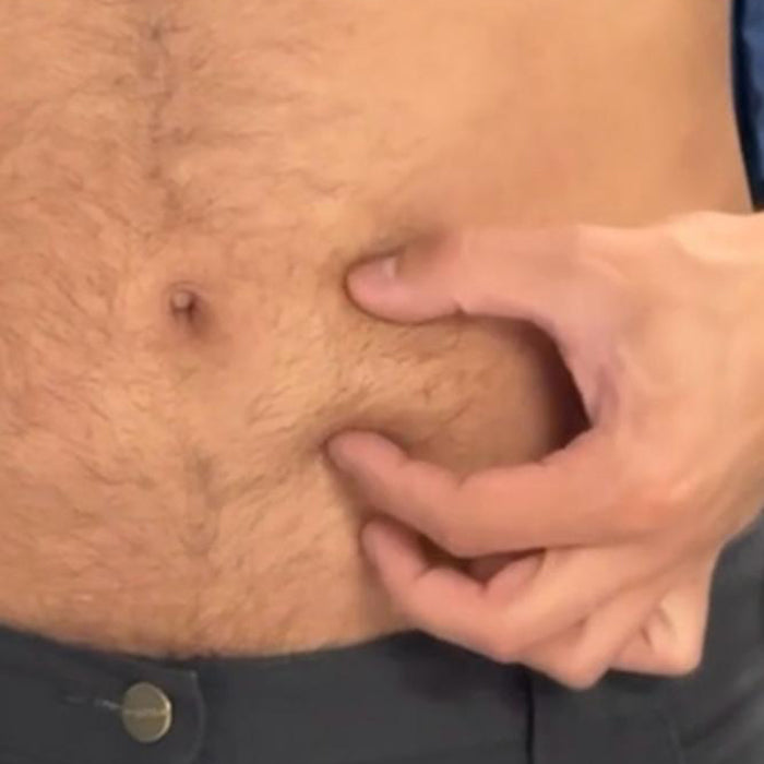 Corrección de Fibrosis